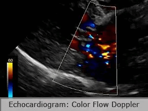 Veterinary Echocardiography Of A Dog With Mitral Valve Disease