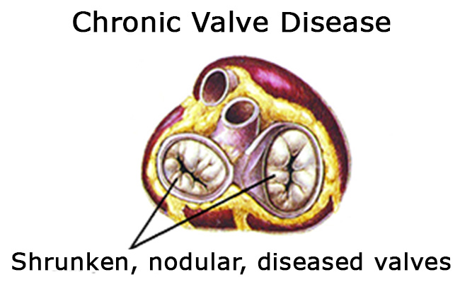 Mitral Valve Disease In the Dog Causing A Heart Murmer